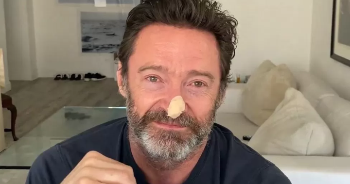 Hugh Jackman reveals new cancer scare, urges people to stop tanning – National