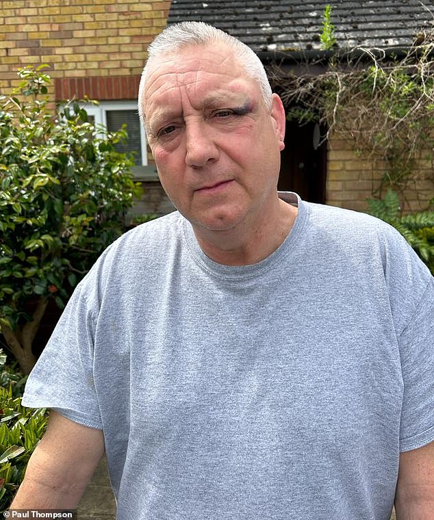 The hero West Ham fan who defended the families of West Ham players from a mob of Dutch hooligans last night is 58-year-old father-of-four Chris Knoll, who is recovering from hip replacement surgery, MailOnline can reveal
