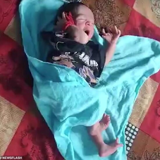The newborn girl (pictured) was born with 26 toes and fingers