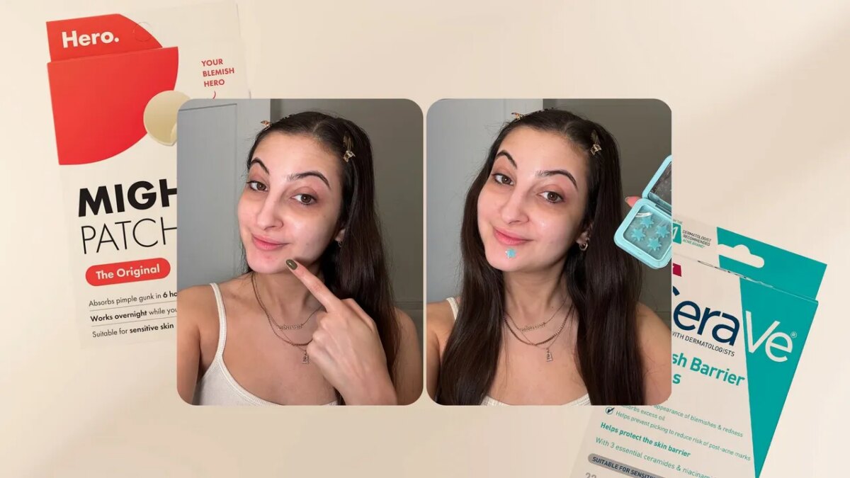 6 Best Pimple Patches for Every Breakout 2026, Tested & Reviewed