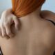 Shingles facts: 6 Things Doctors Wish You Knew About Shingles