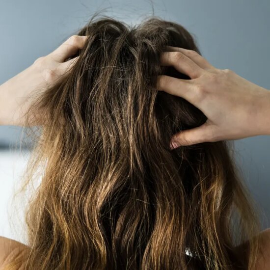 How to Get Rid of Dandruff, According to Dermatologists in 2026